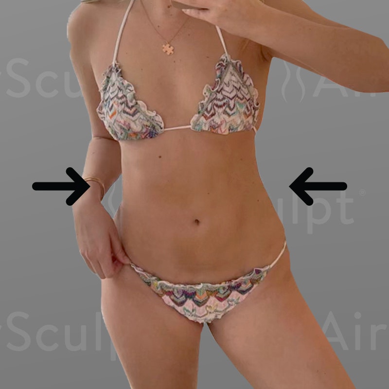 Audrey Stomach After