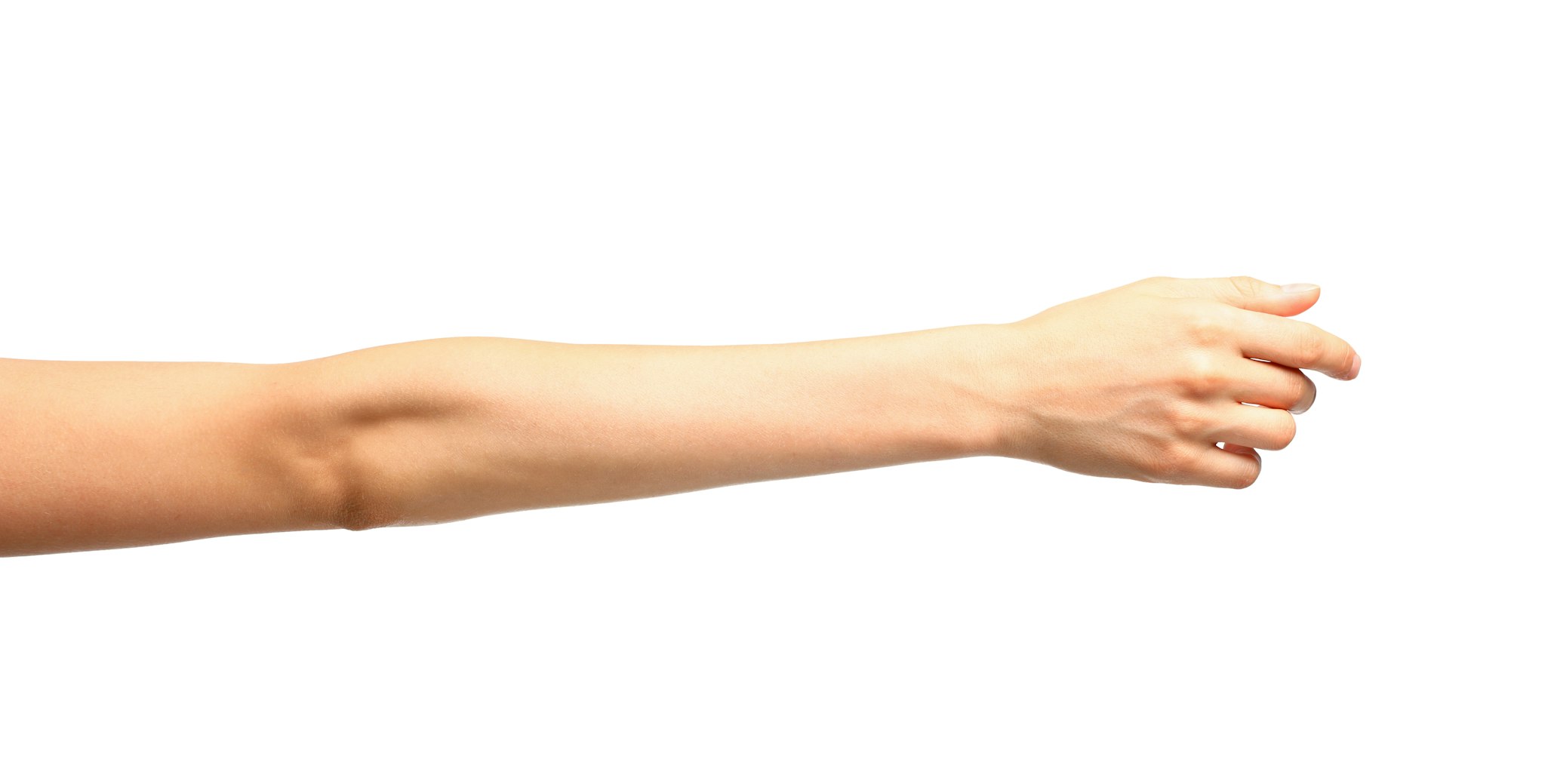 arm