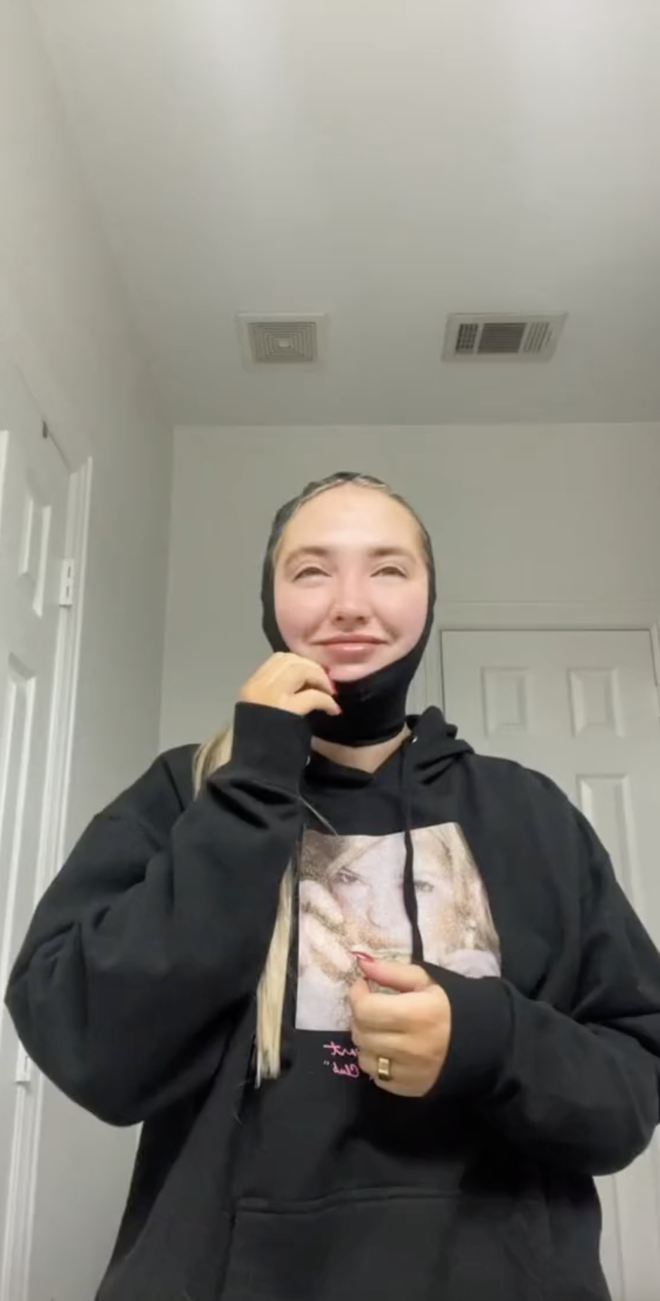 thumbnail photo of Kenzie Elizabeth with a chin compression garment on