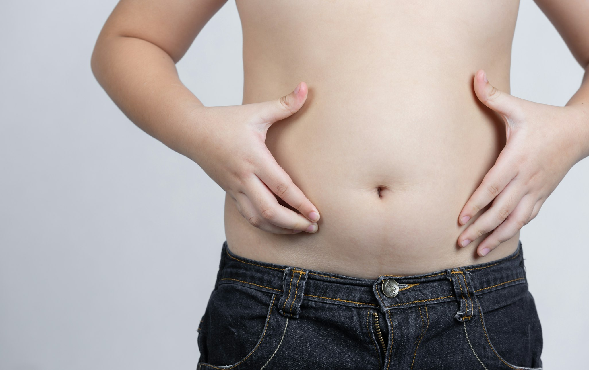 What is Subcutaneous Fat and How Can I Reduce It?