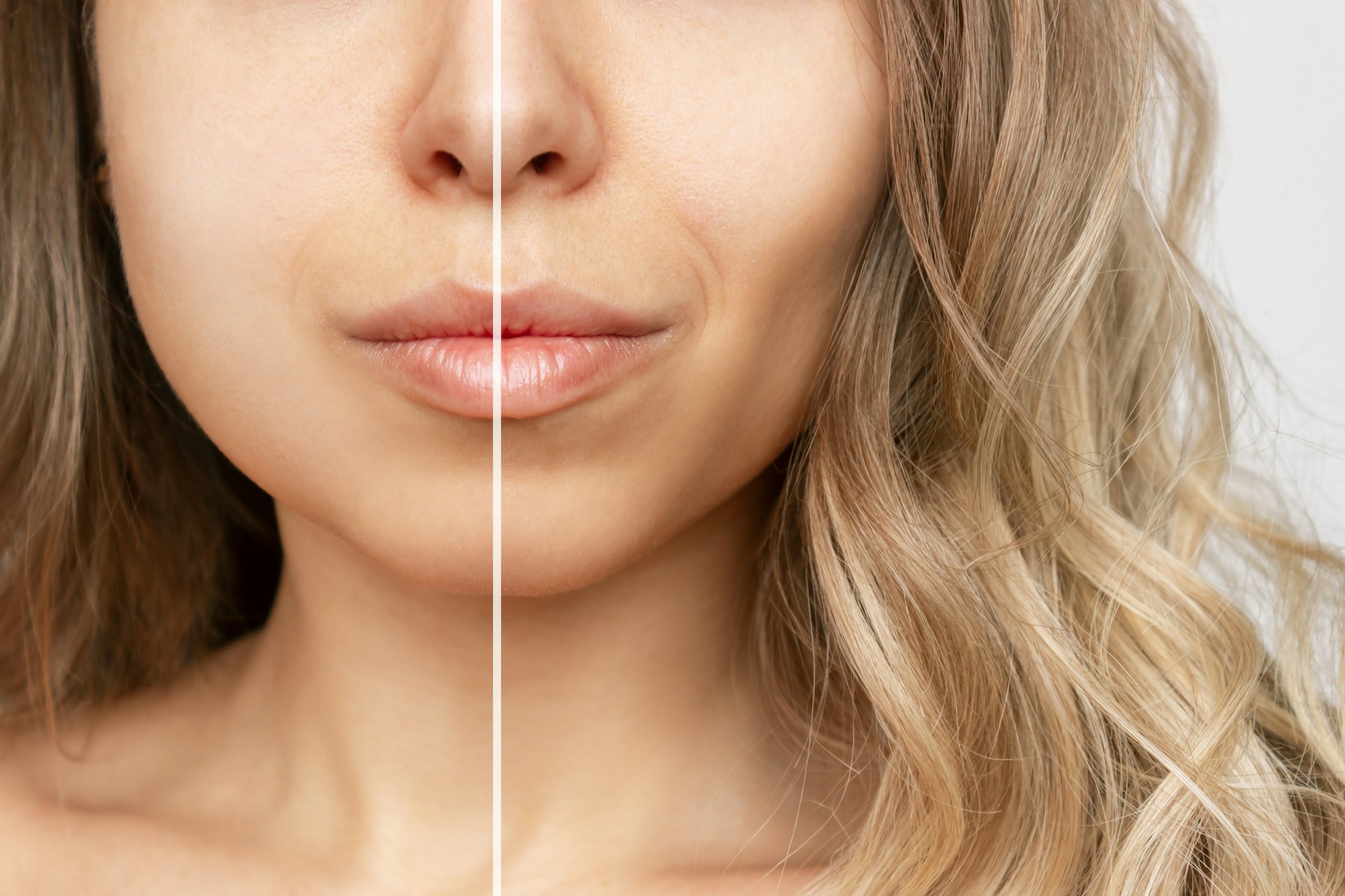 Cropped shot of young caucasian blonde woman with wavy hair before and after plastic surgery buccal fat pad removal.