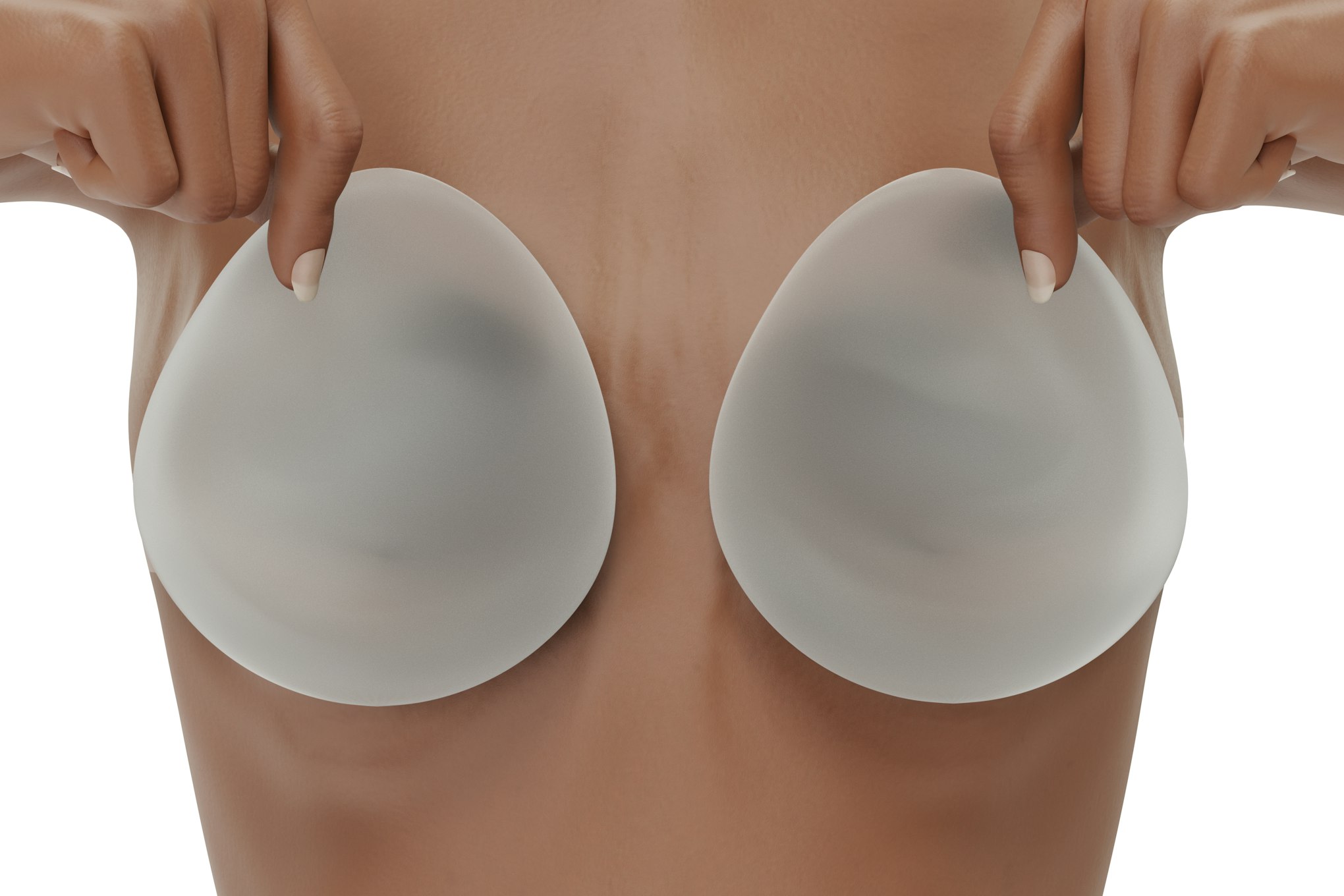 Woman covers her breasts with textured saline implants