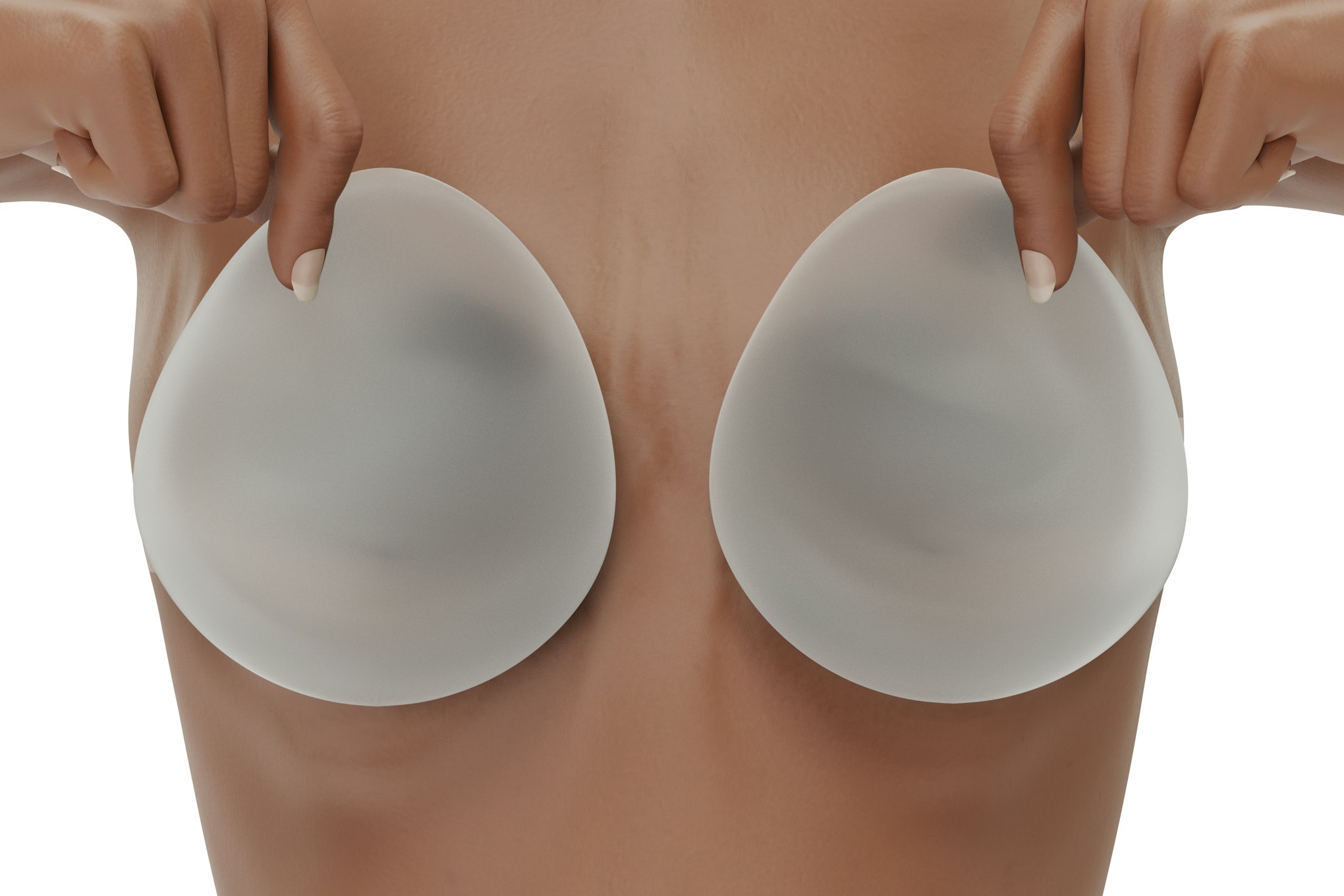 Breast Implants Miami - Silicone and Saline