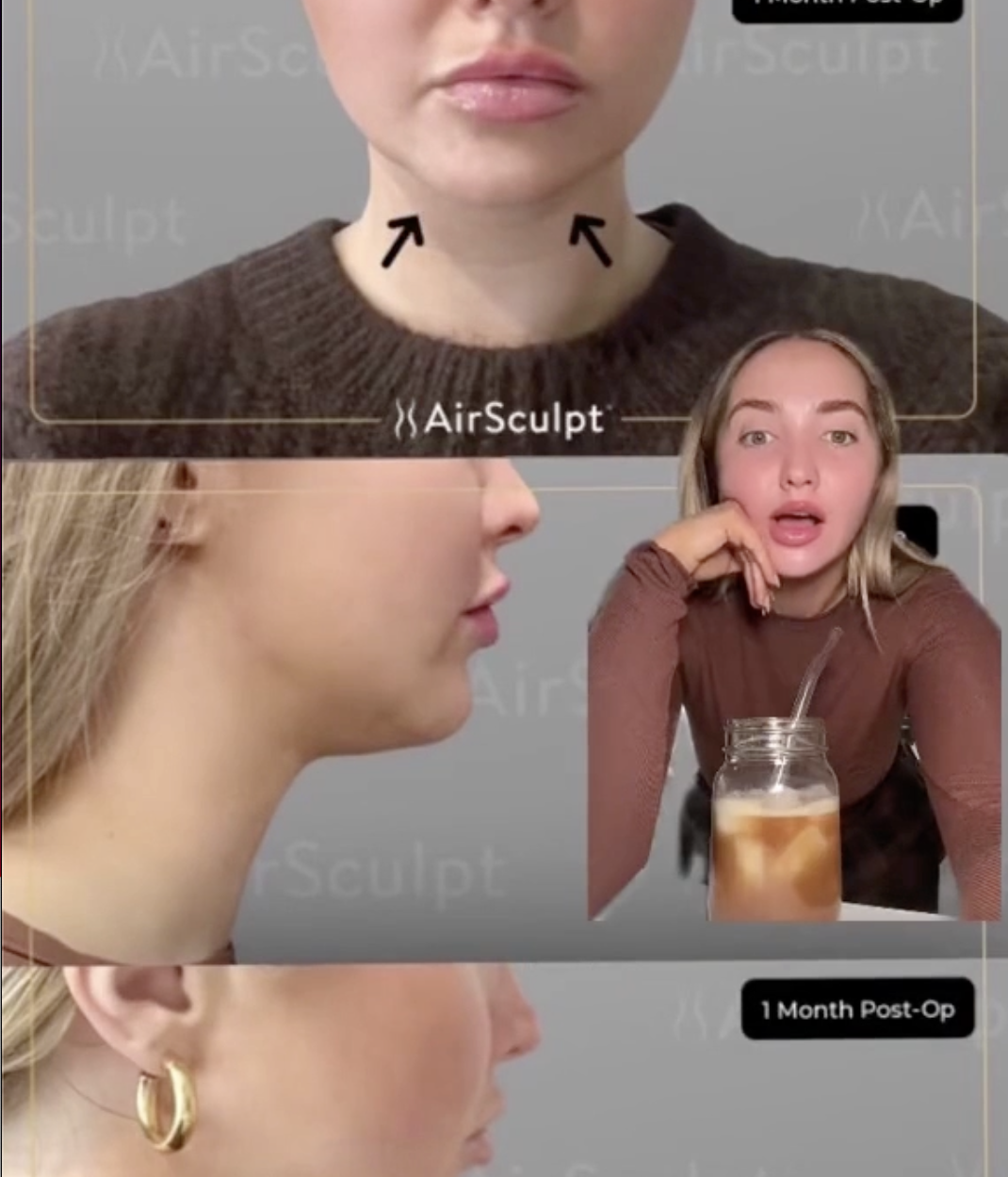 Kenzie Elizabeth one month update Tik Tok thumbnail; before and after image