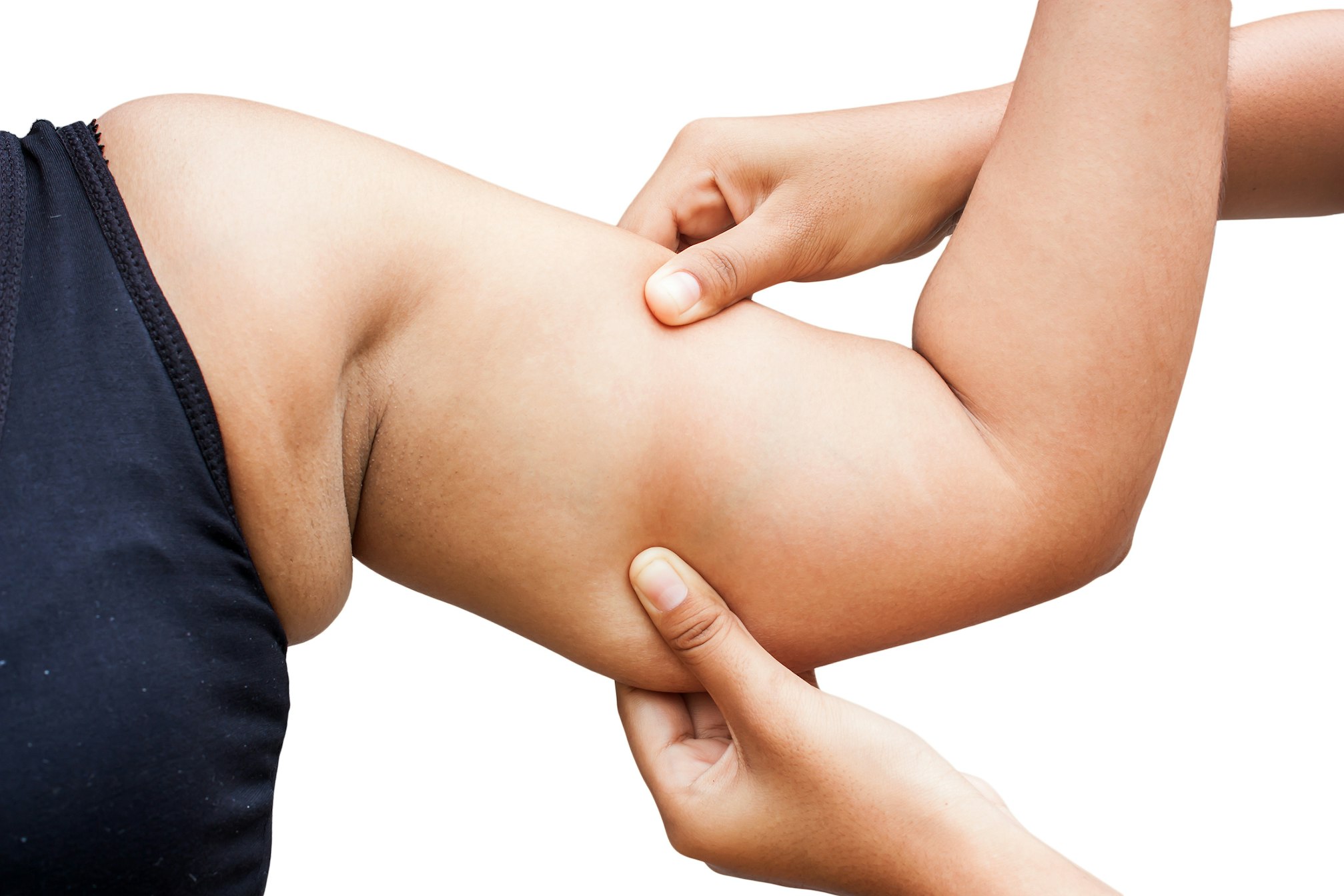 women show fat wrinkle of armpit isolate background