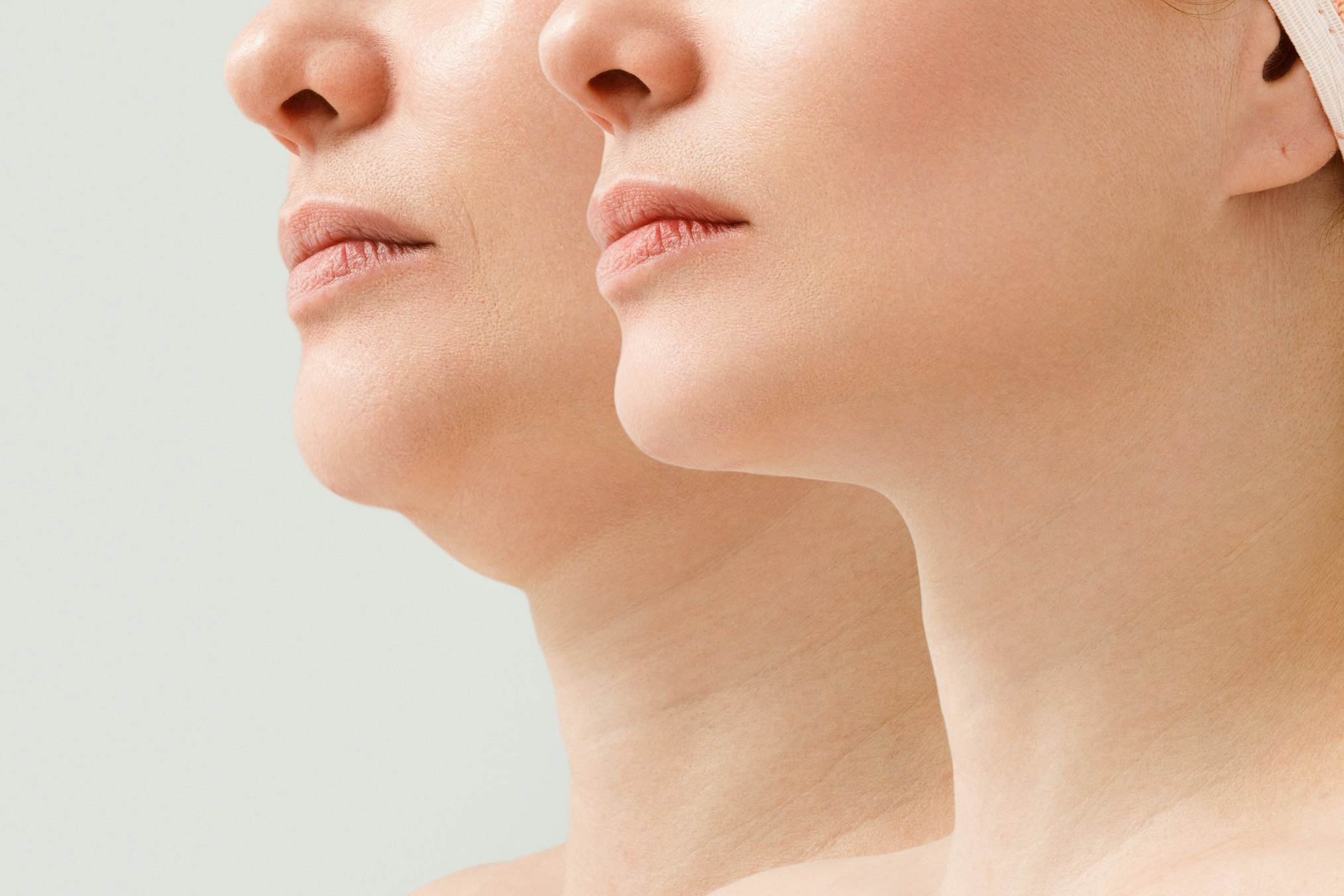 A close portrait of an aged woman before and after the facelift procedure.