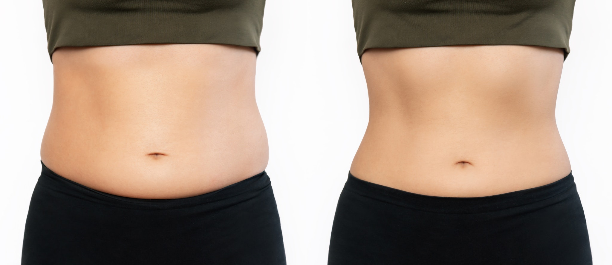Two shots of a woman's belly with excess fat and toned slim stomach with abs before and after losing weight isolated on a white background.