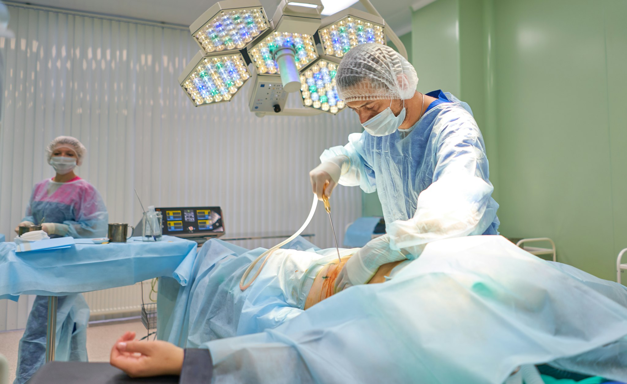 surgeon during liposuction