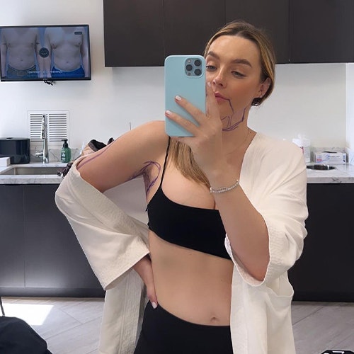 Lauryn Bosstick before iamge selfie with markings on chin and armpits