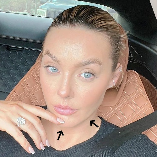 Lauryn Bosstick after image showing her contoured jawline