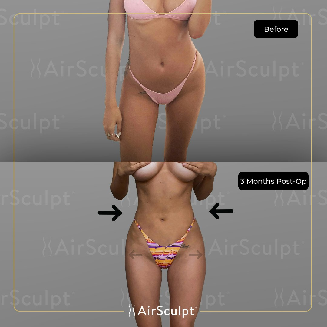 Jordana Barnes before and after image showing her narrowed waist and curvier figure