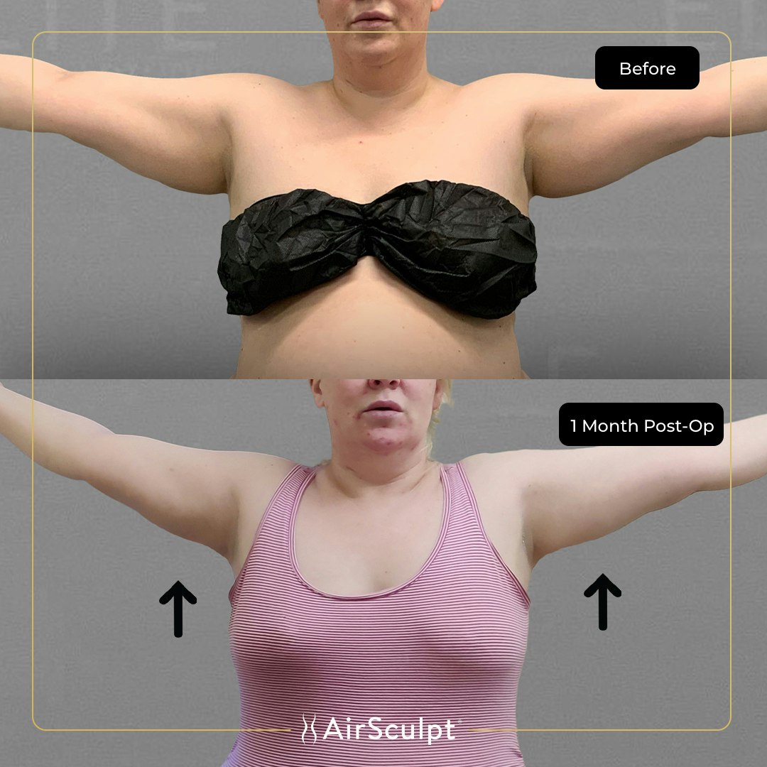 denise before and after