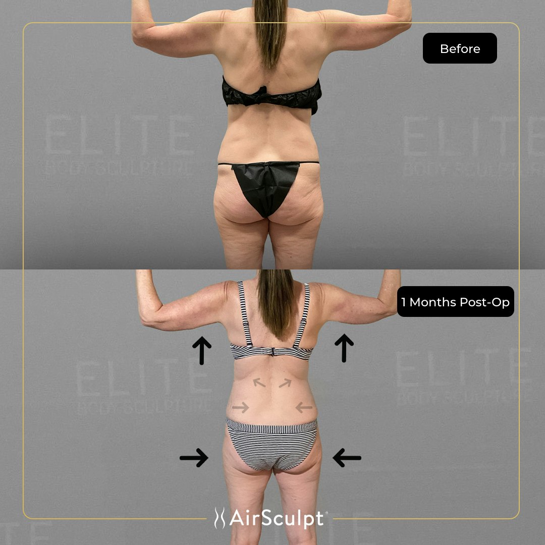 chanette before and after