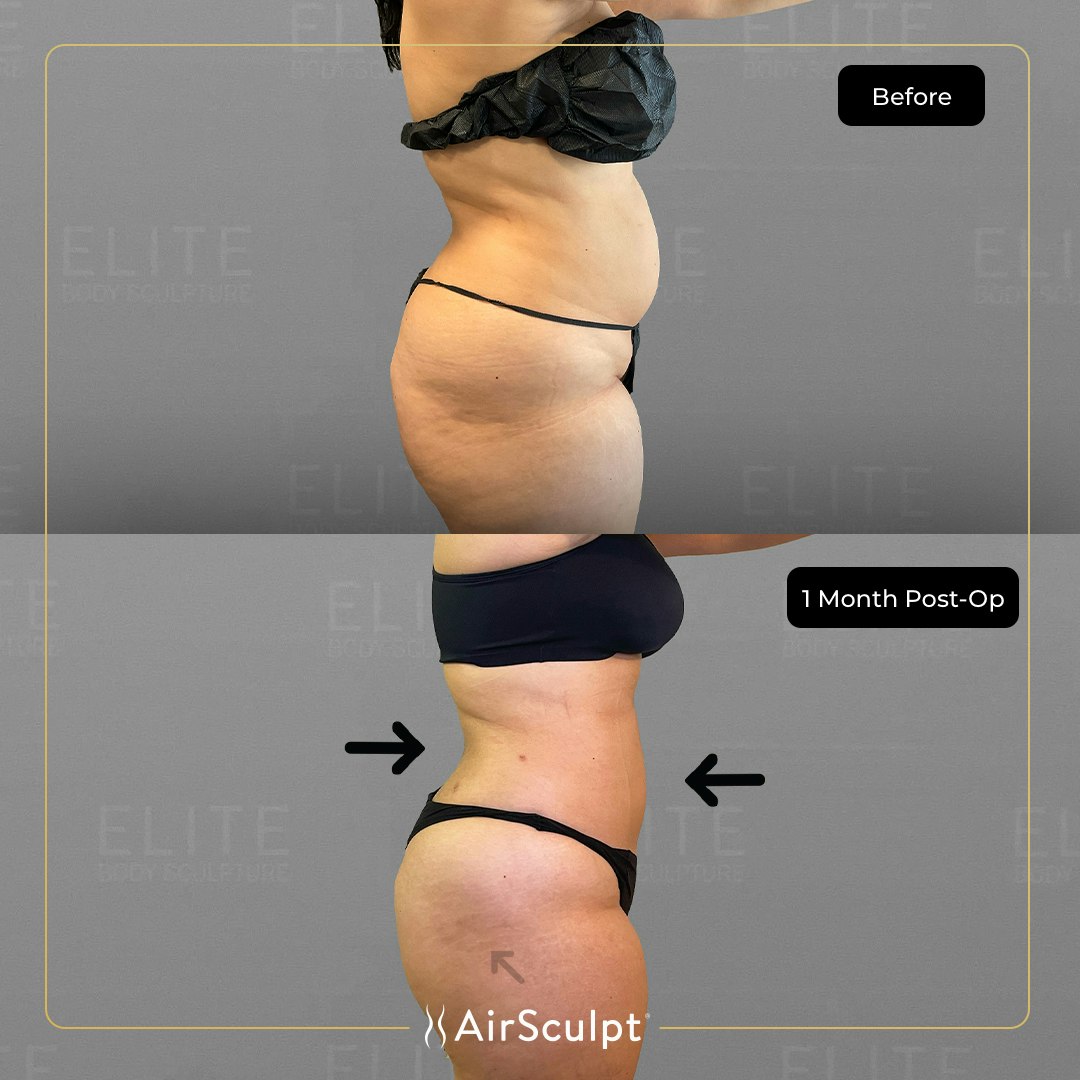 jackie before and after