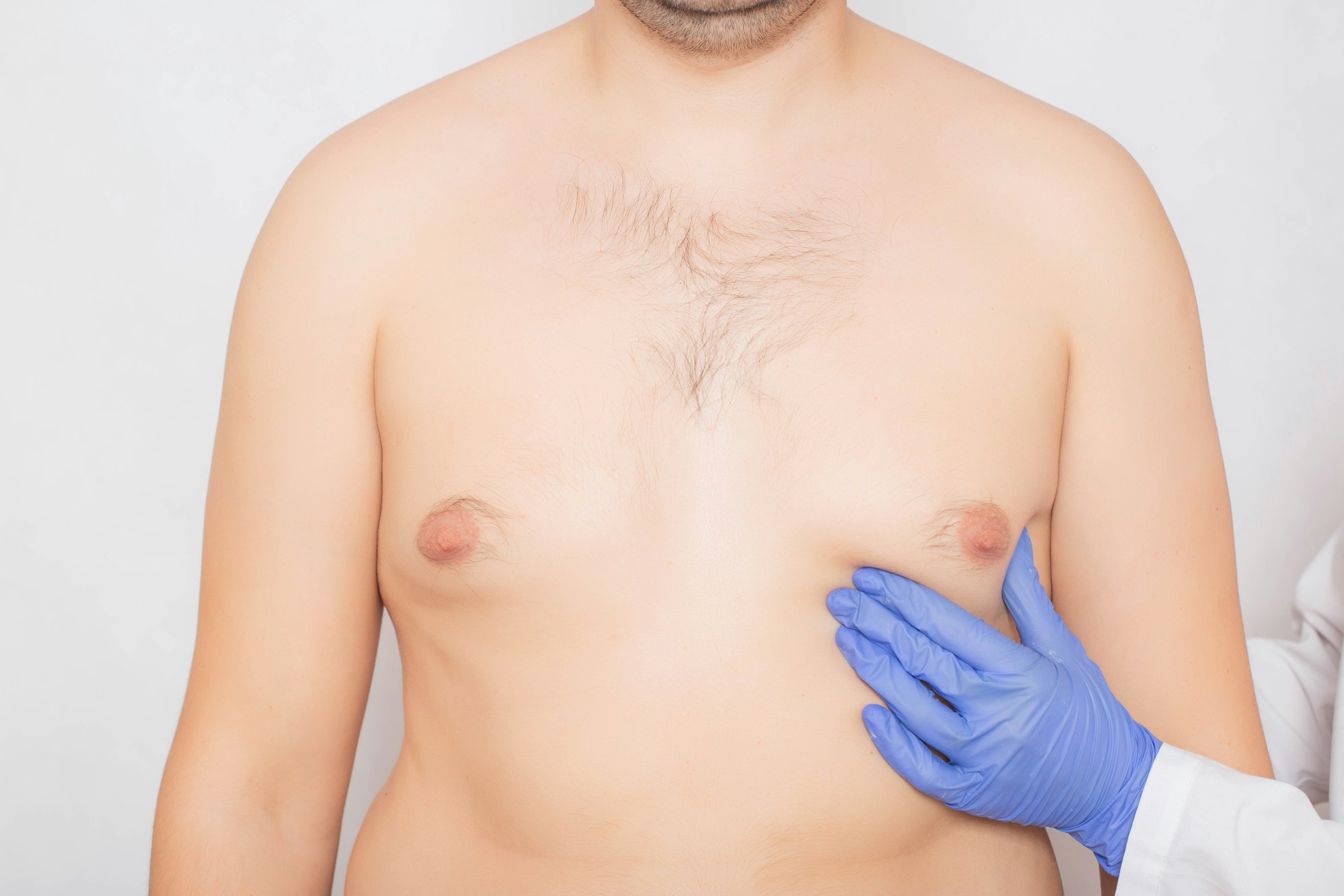 Nipple & Areola Reduction Scottsdale