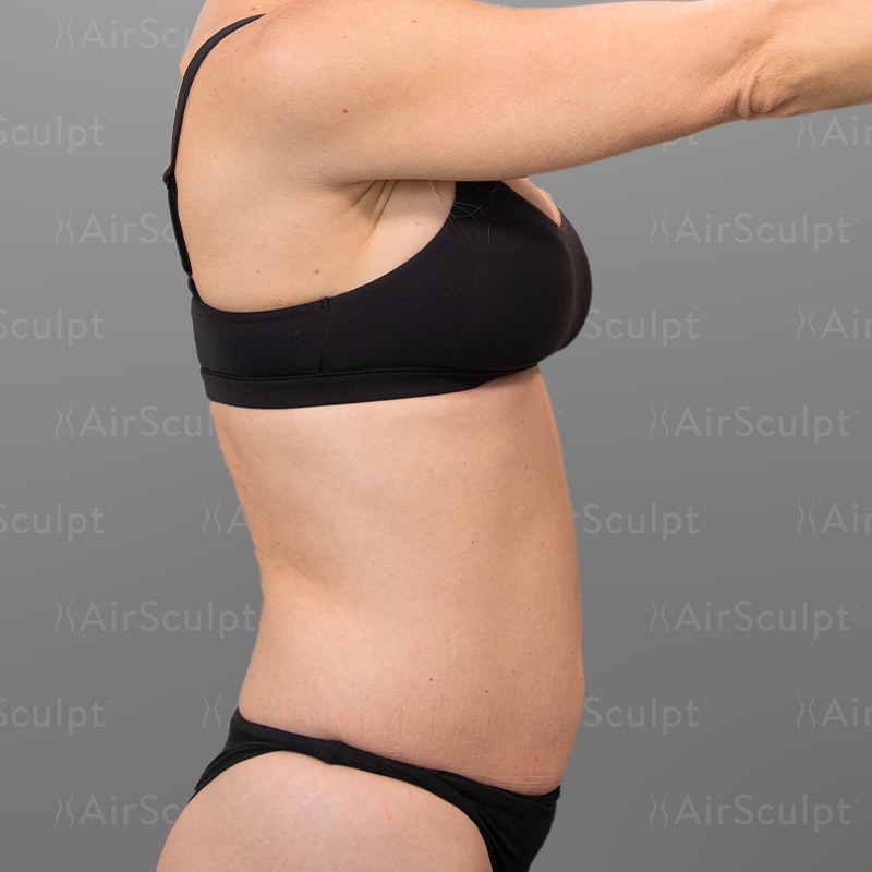 Jenny McCarthy Side Before