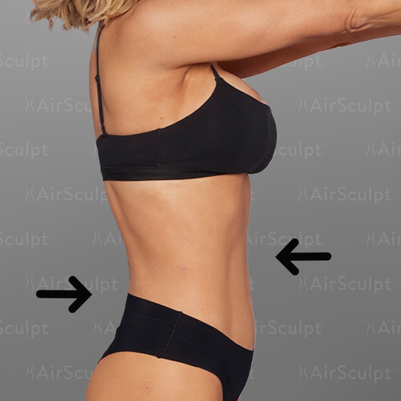 Jenny McCarthy Side After