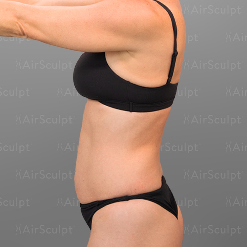 Jenny McCarthy Side Before