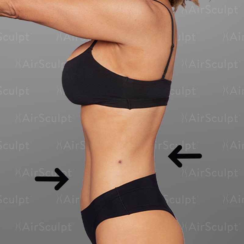 Jenny McCarthy Side After