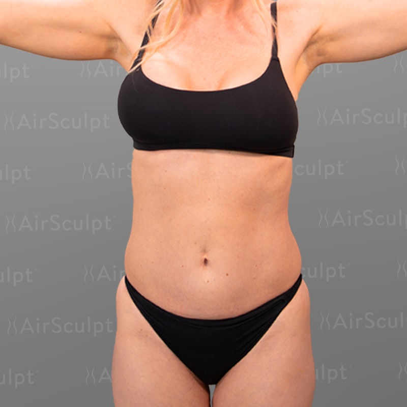 Jenny McCarthy Front Before