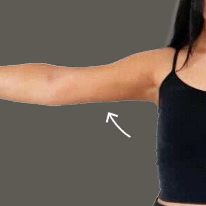 After AirSculpt