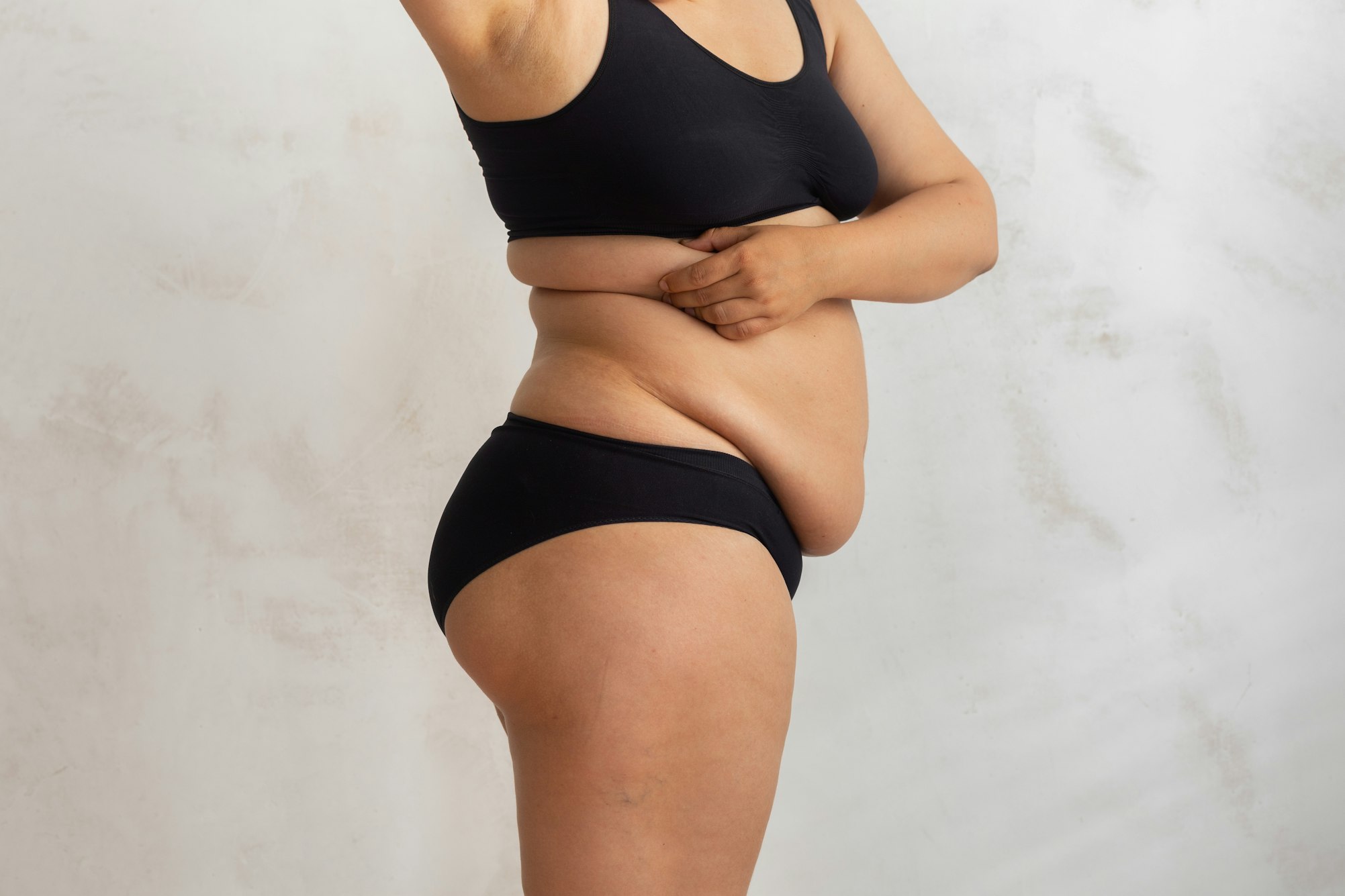 loose skin picture