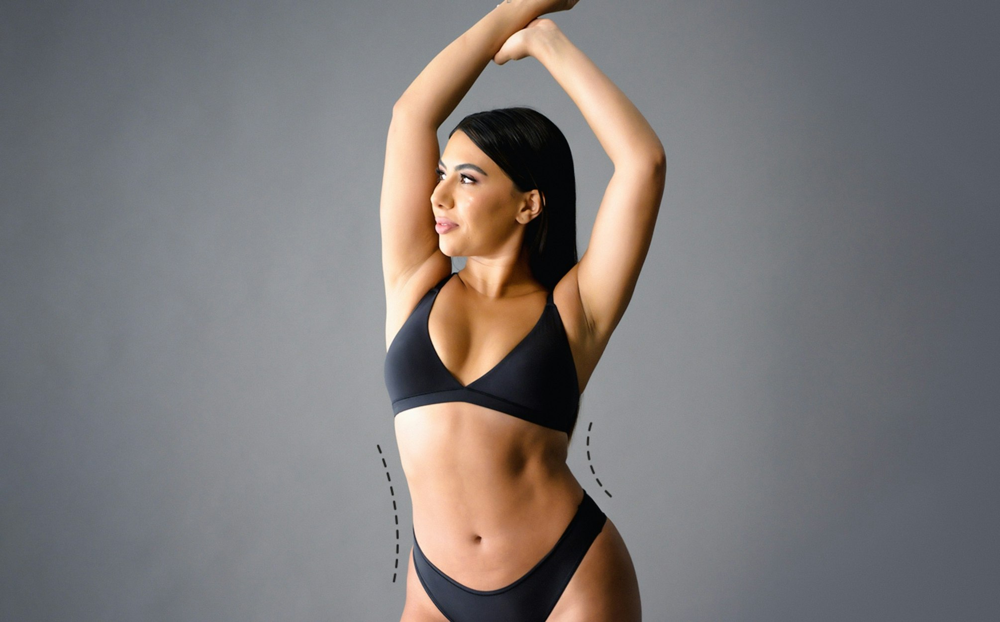airsculpt patient posing in black bikini