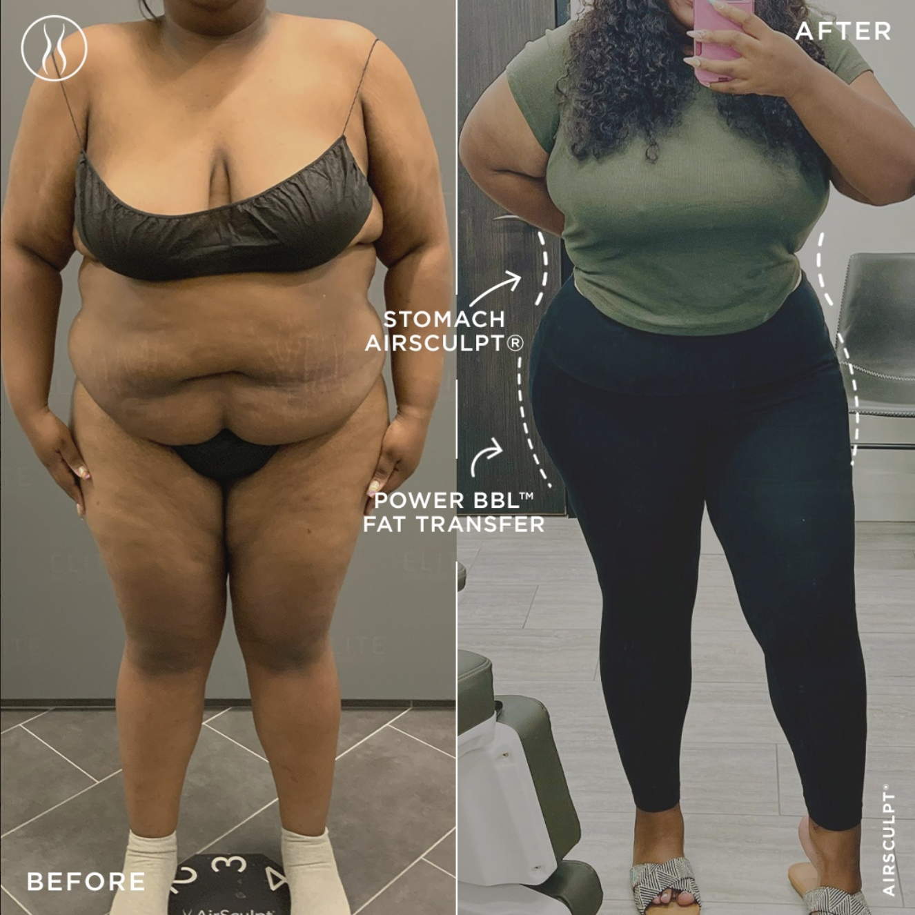 plus-sized BBL before and after shot