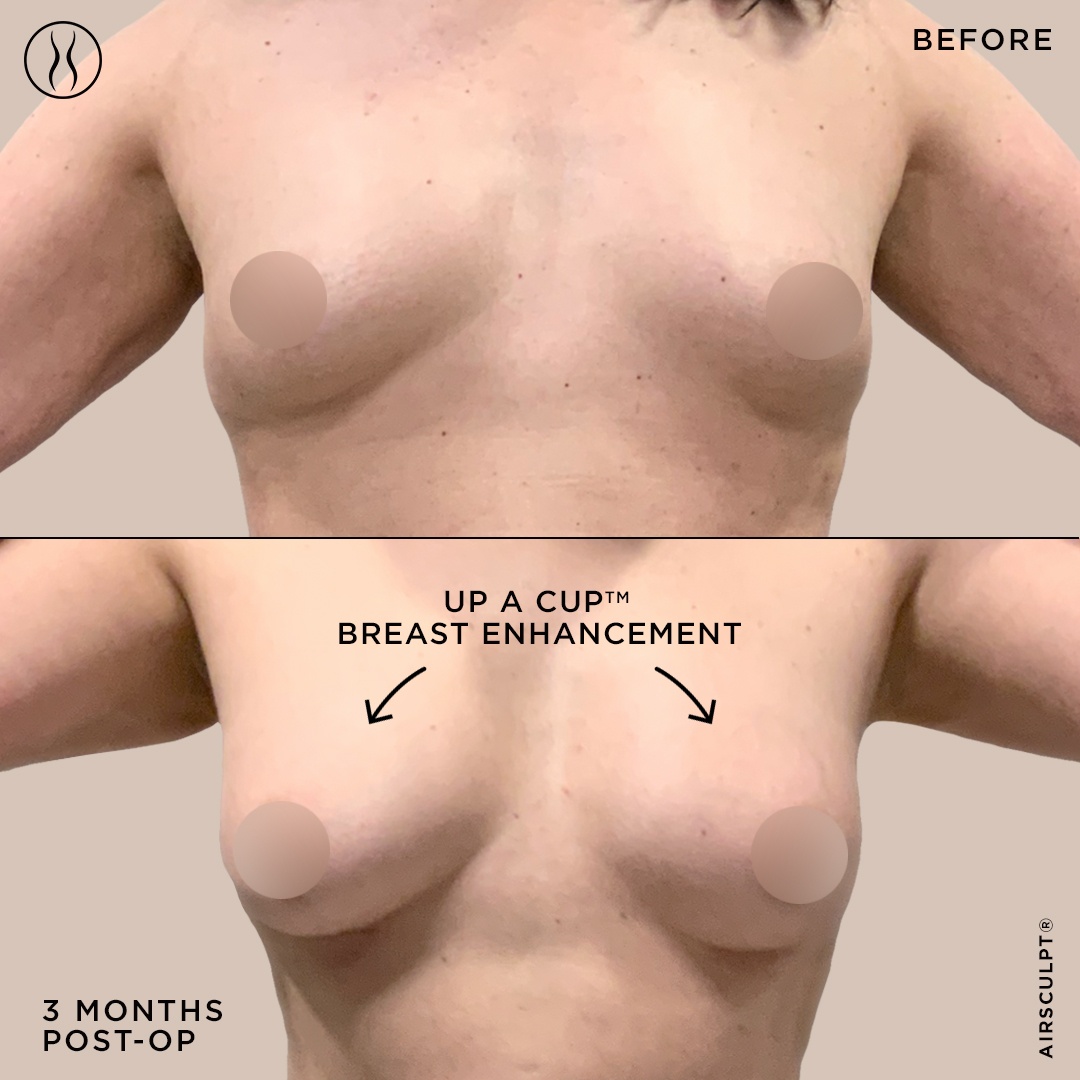 natural breasts