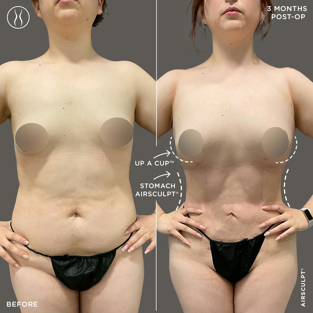 natural breasts