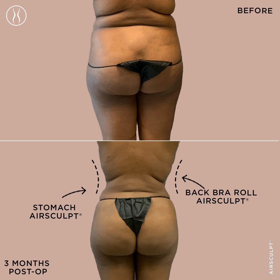 A Complete Guide To Getting a Bigger Butt and Curvier Figure