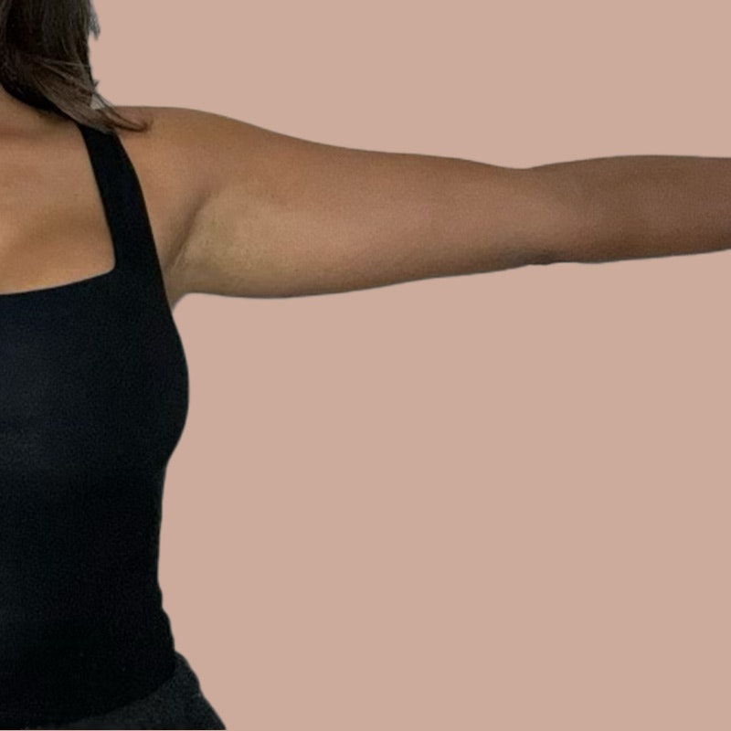Arm before airsculpt