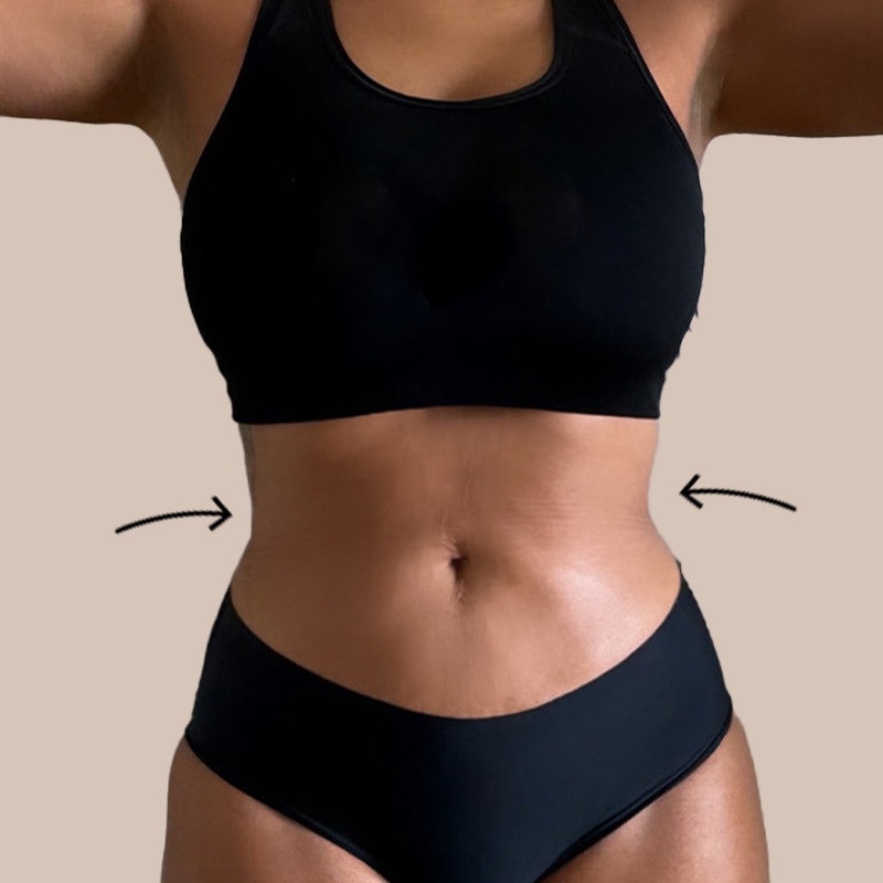 Cheyenne stomach post-op