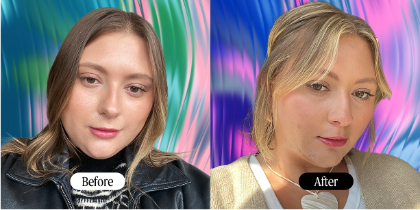 chin airsculpt before and after