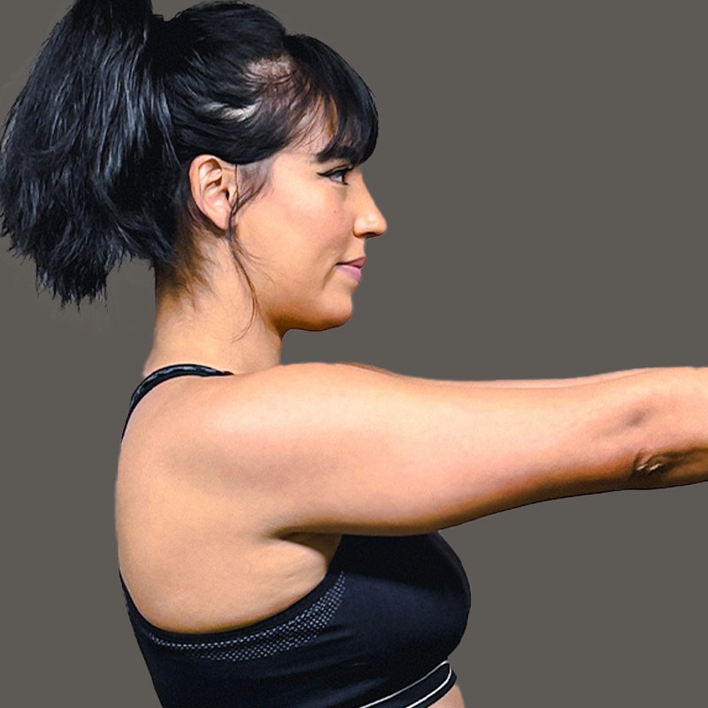 Danielle Olivera Side Before