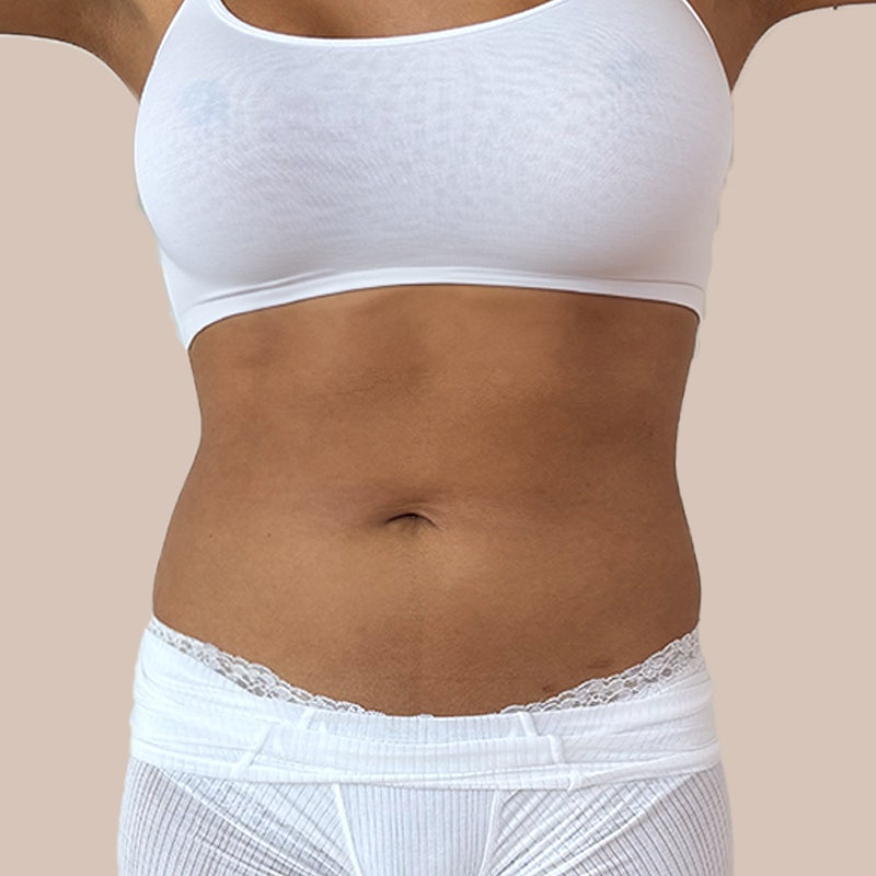 Before stomach AirSculpt