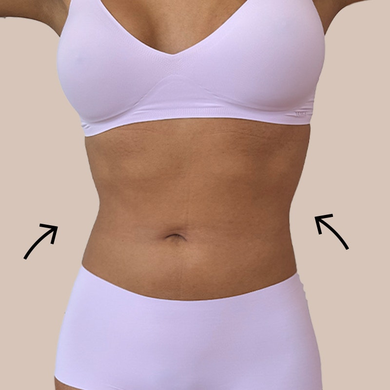 Before stomach AirSculpt