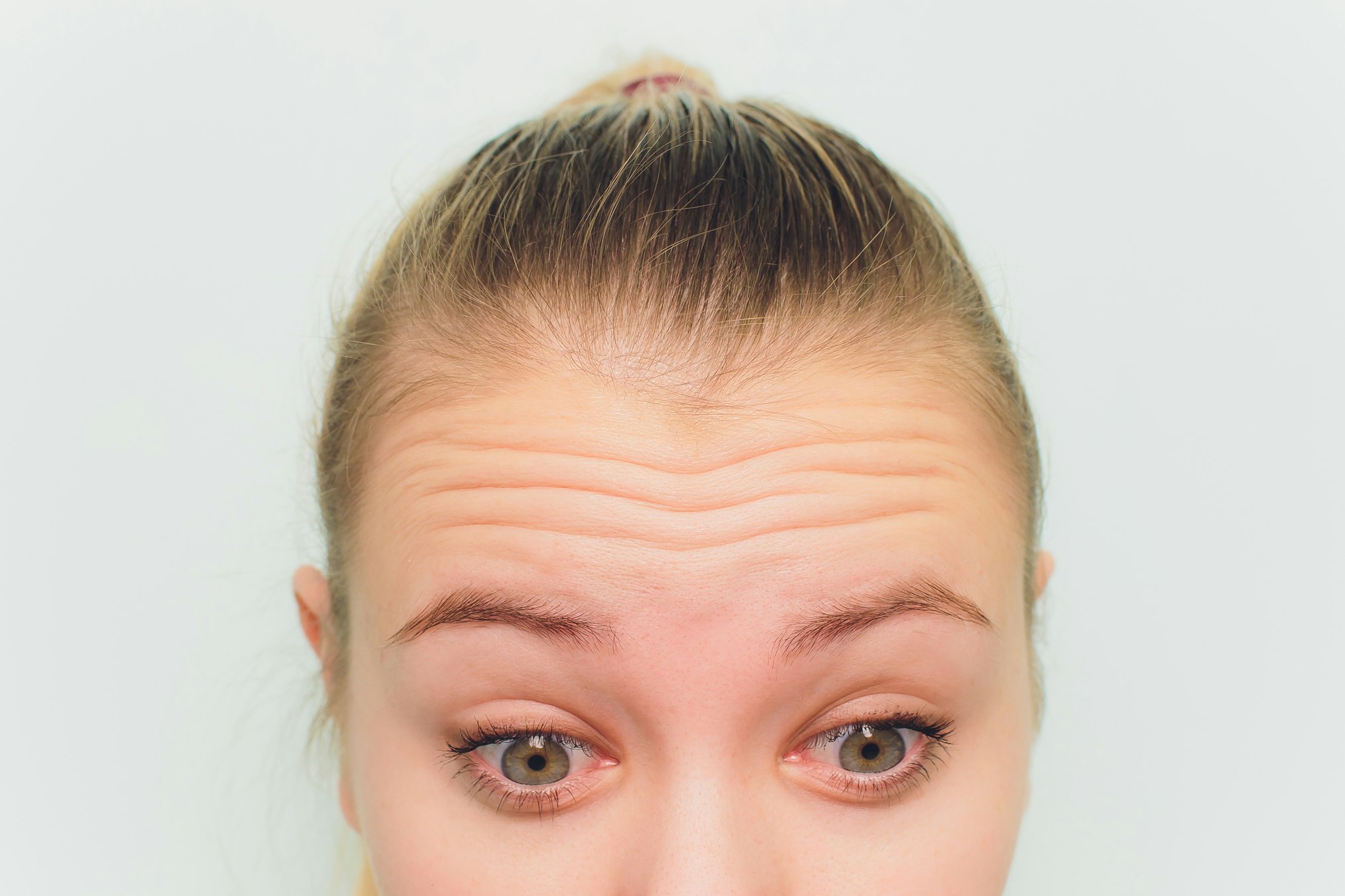 Doctor giving face lifting injection on mid age woman in the forehead between eyebrows to remove expression wrinkles in a clinic surgery room O.R background Beautify filler for face anti aging