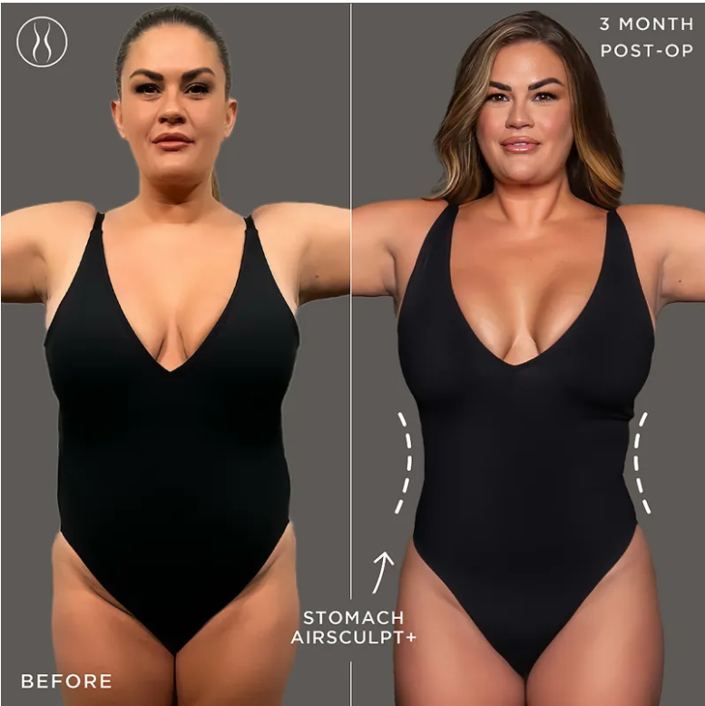 Brittany Cartwright before and after
