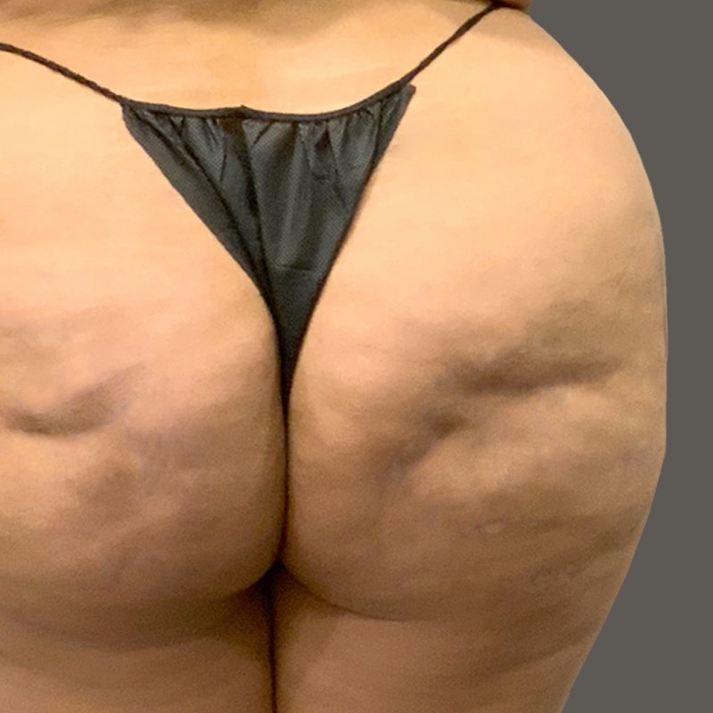 Butt before smooth