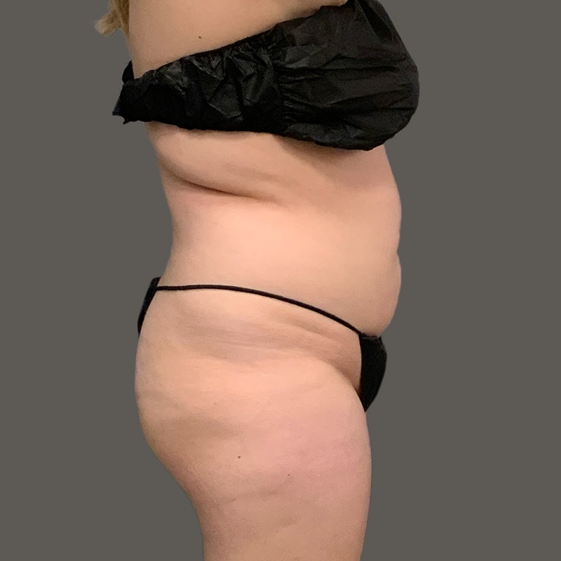 Jenna Goodwin Side Before