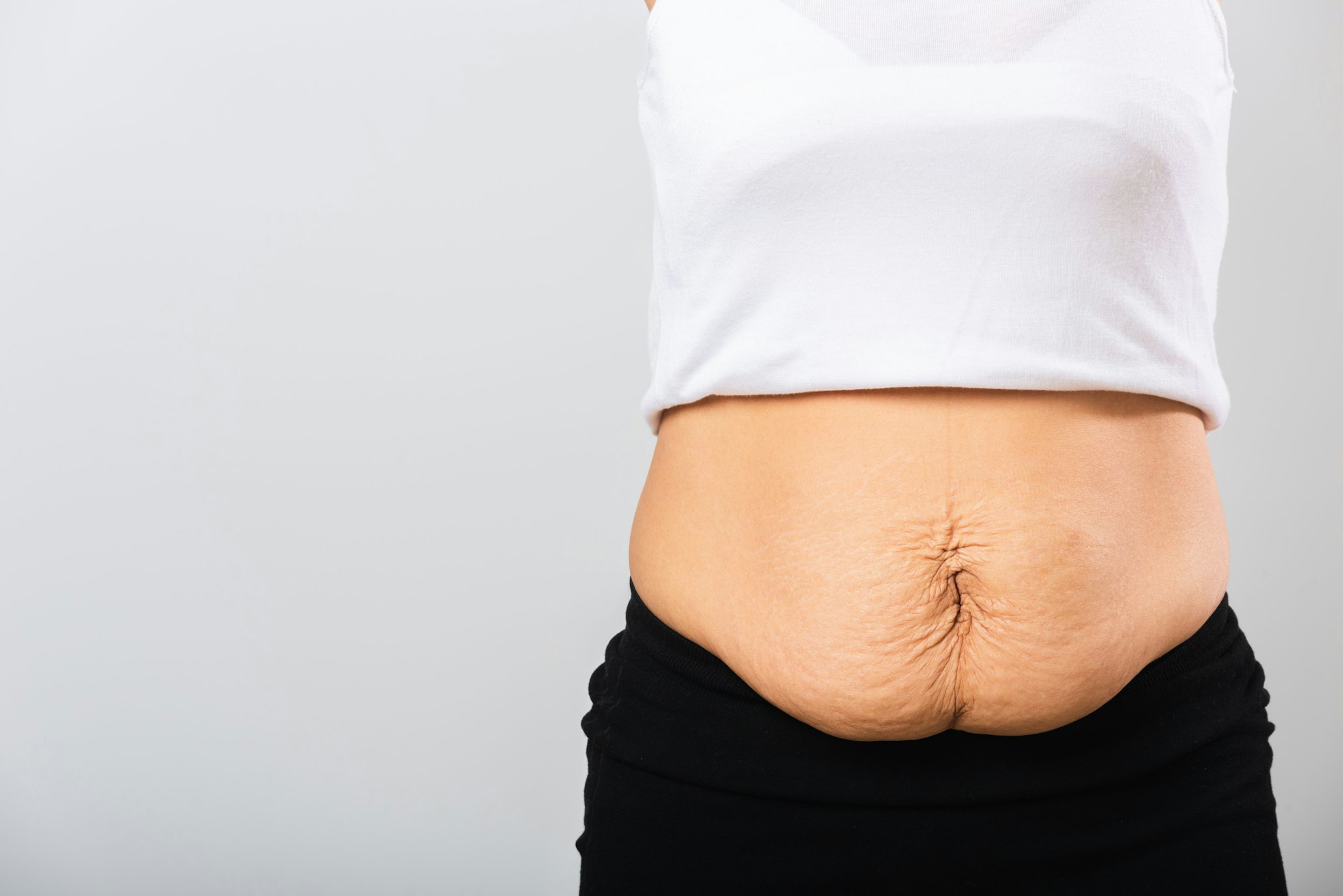 Determining If Liposuction Will Give You a Flat Belly