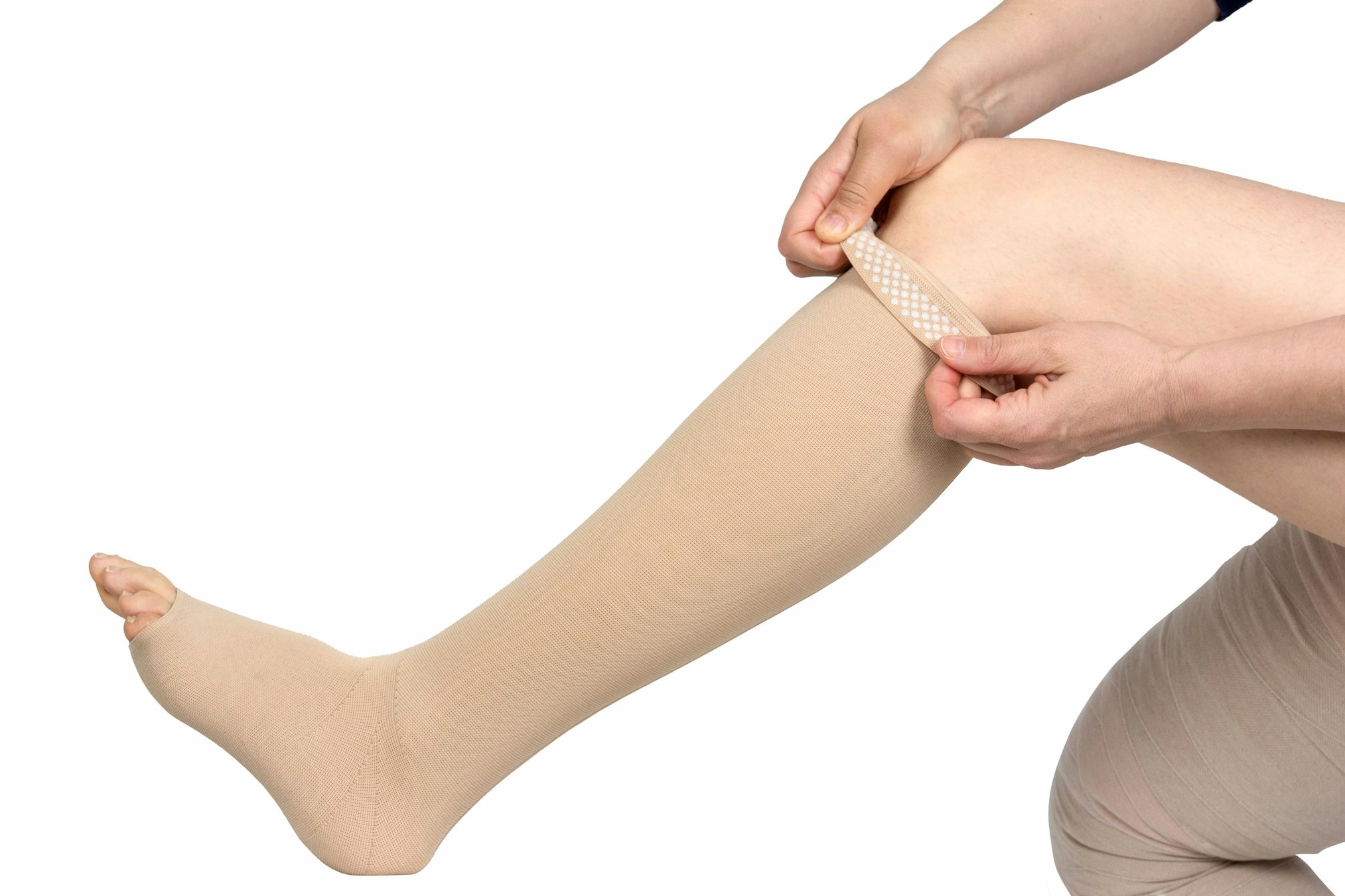 Does Insurance Cover Liposuction For Lipedema, and Which Treatment is Best?