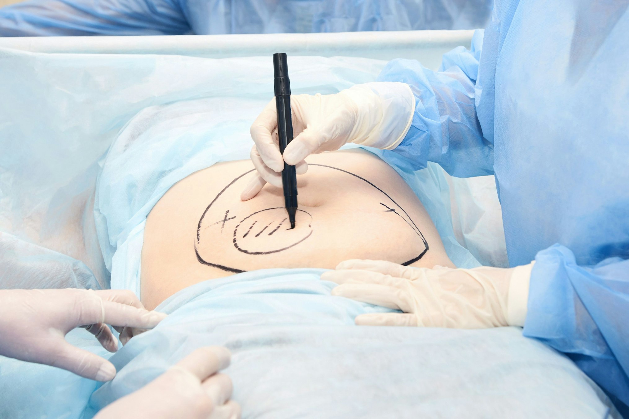 doctors about to begin surgery