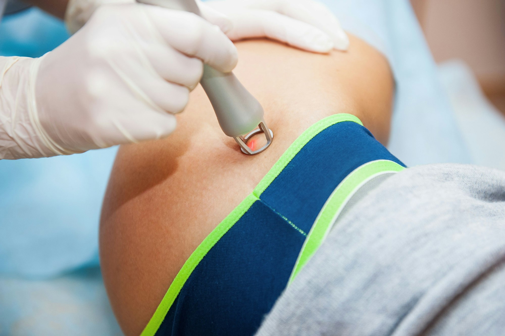 Doctor removing buttock scars