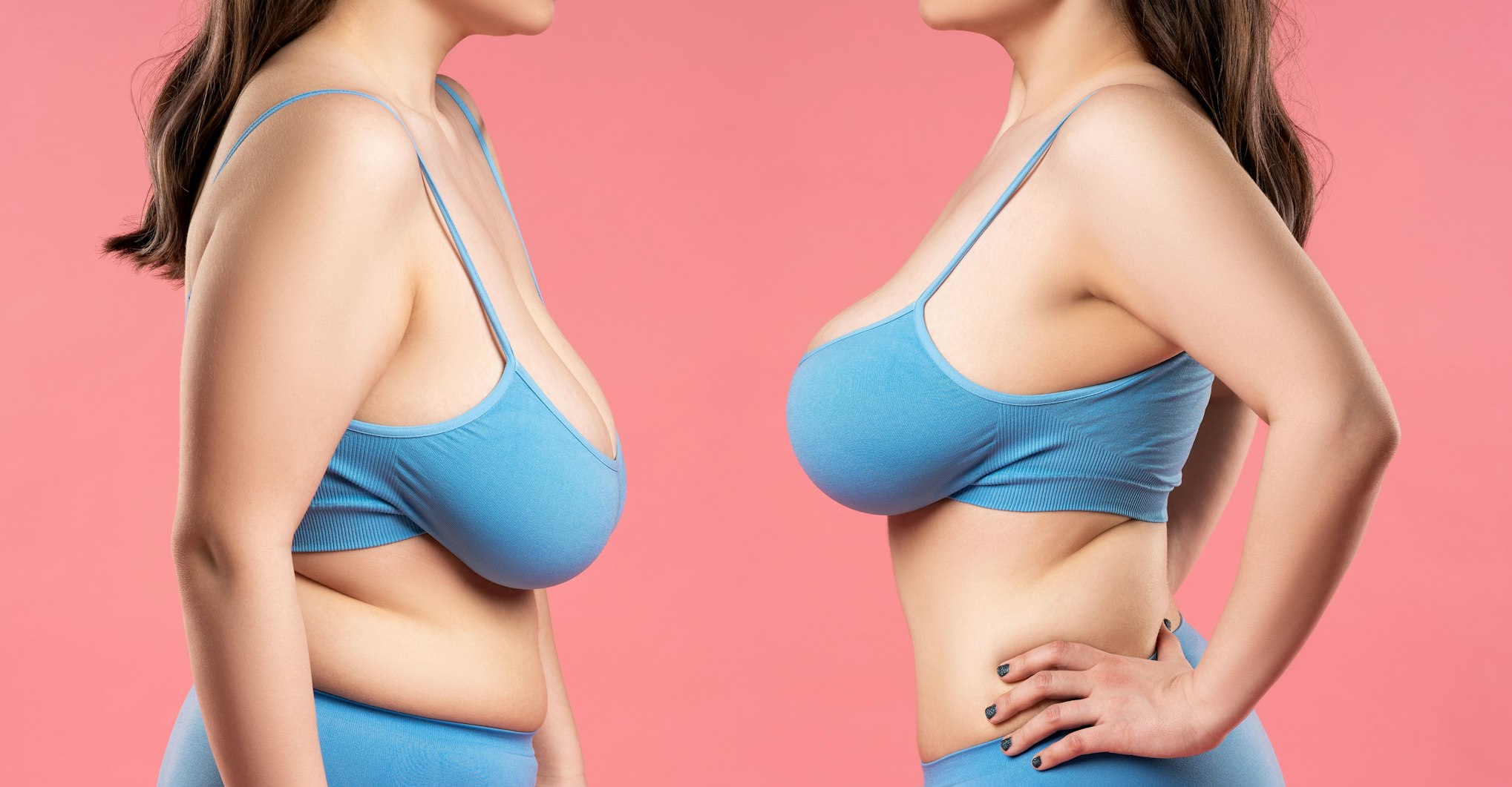 woman body before and after