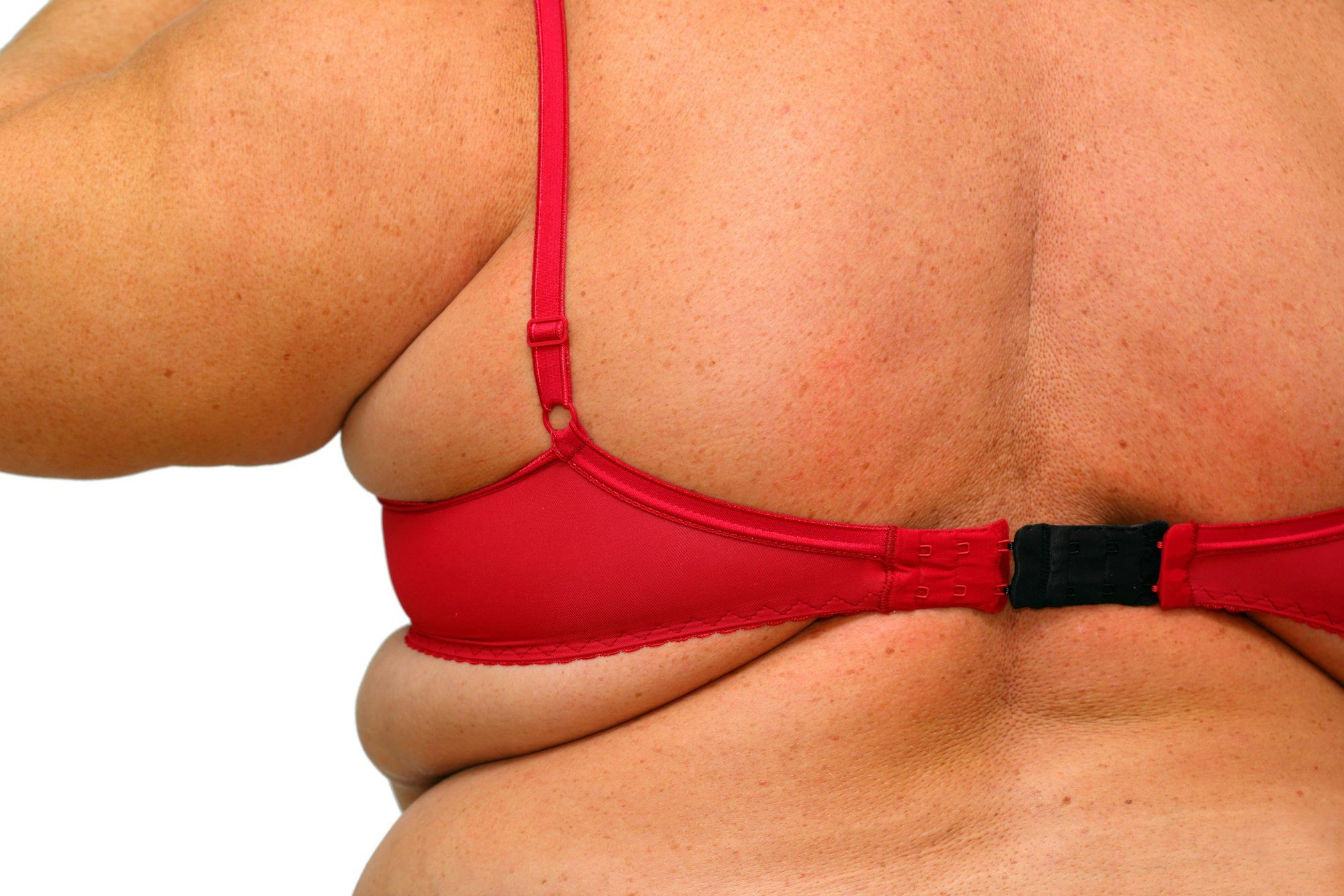 woman with under bra fat