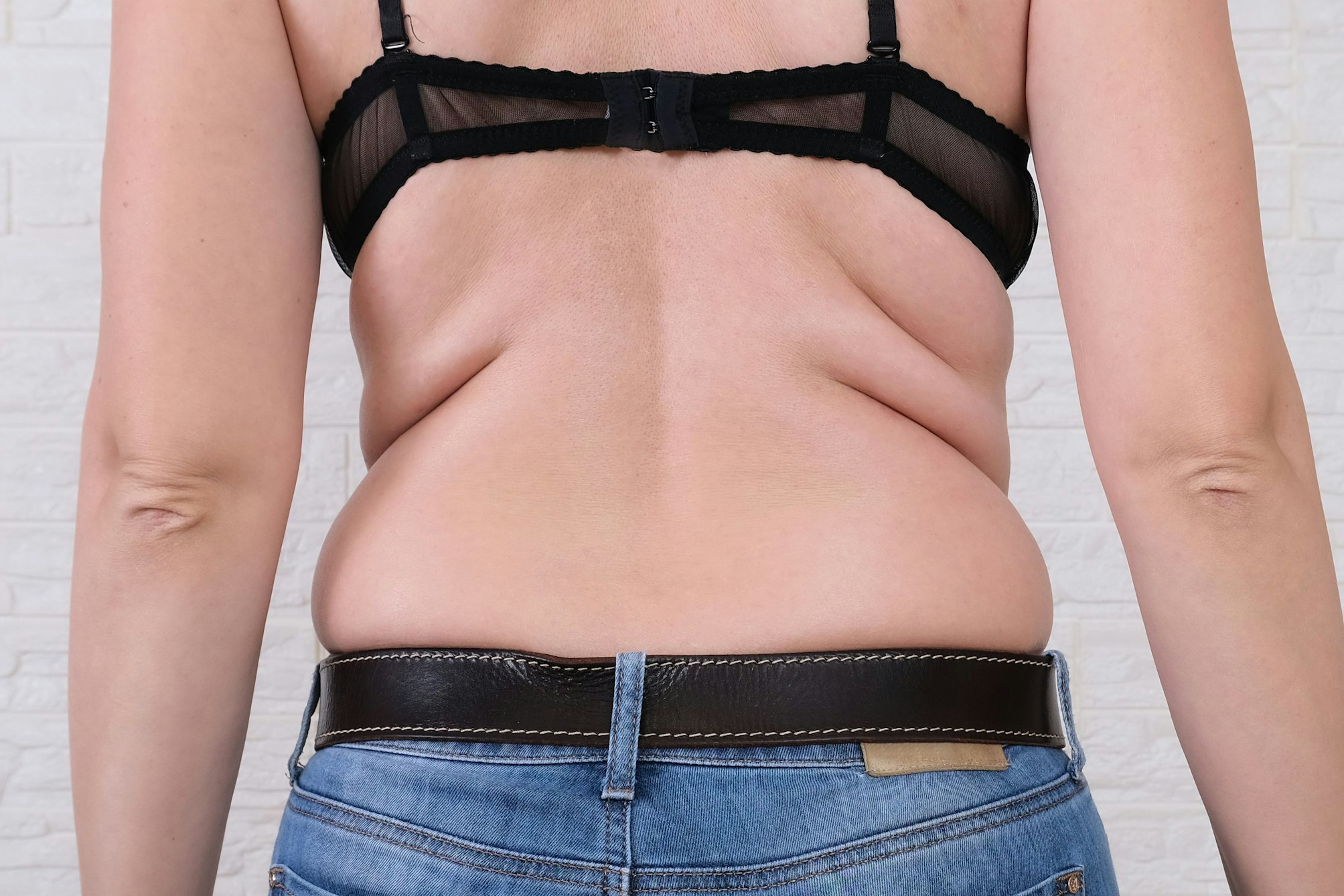 woman with back fat
