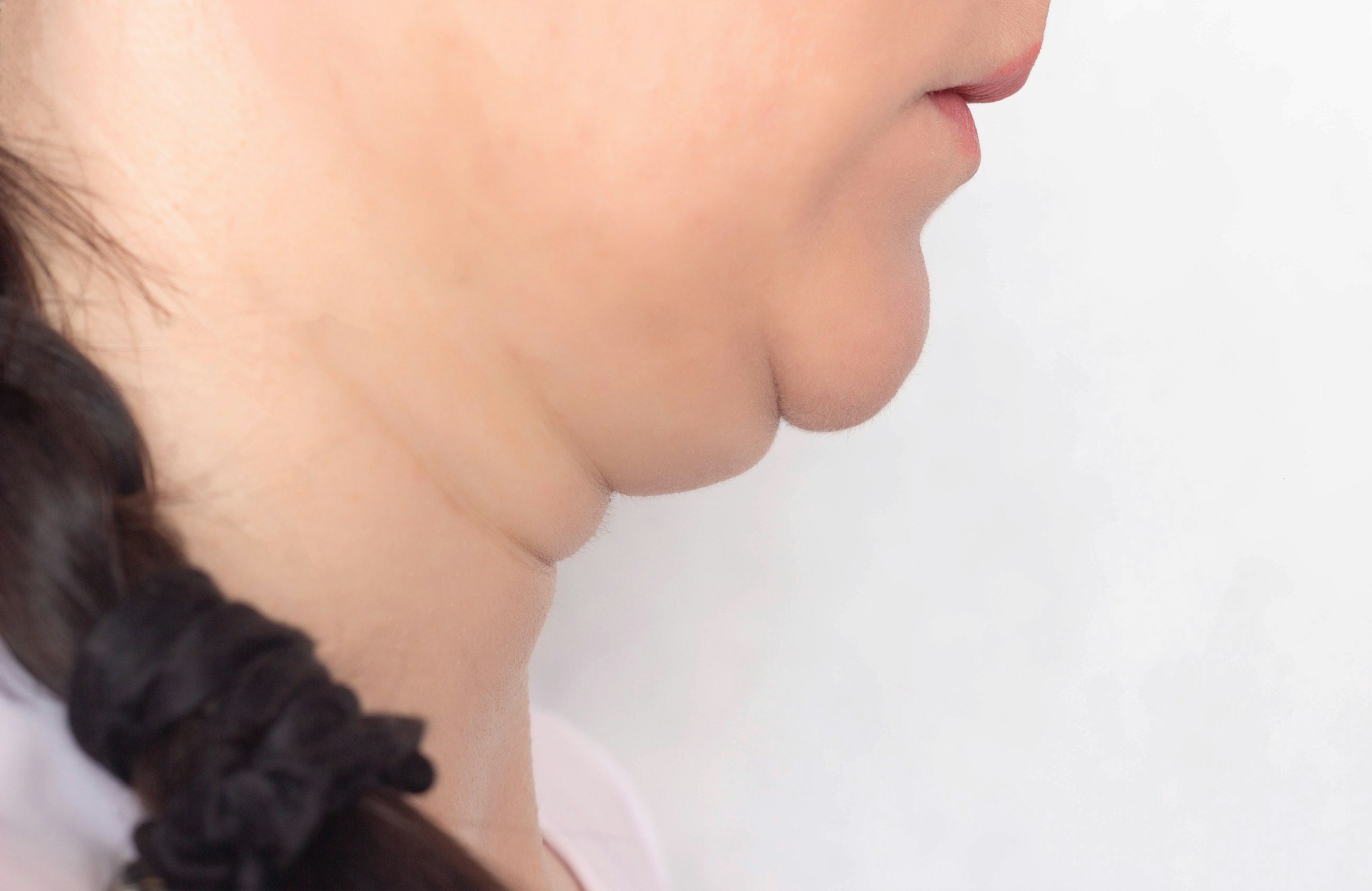 woman with double chin