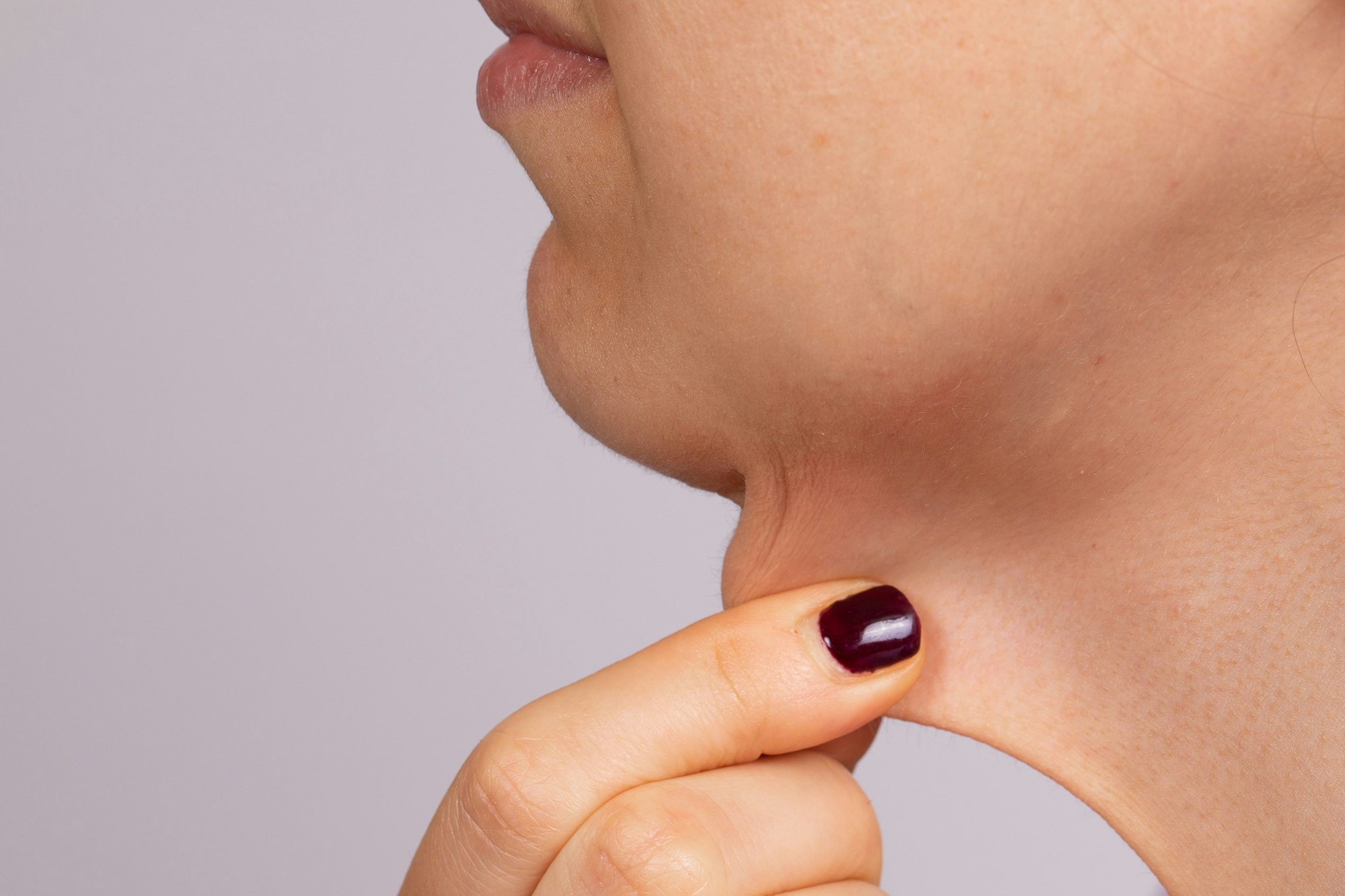 pinching neck